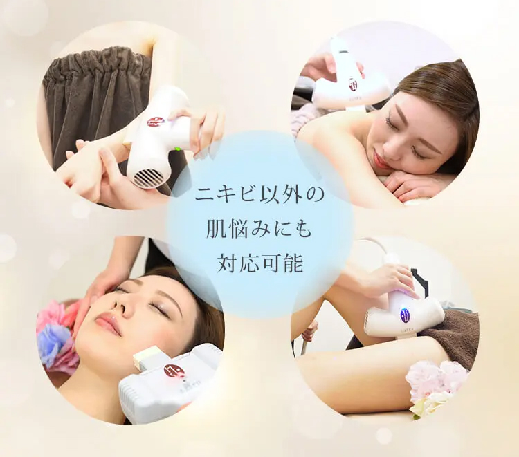 なんばの脱毛サロンエイミーでは肌の悩みに合わせた脱毛が可能な様子を解説した写真