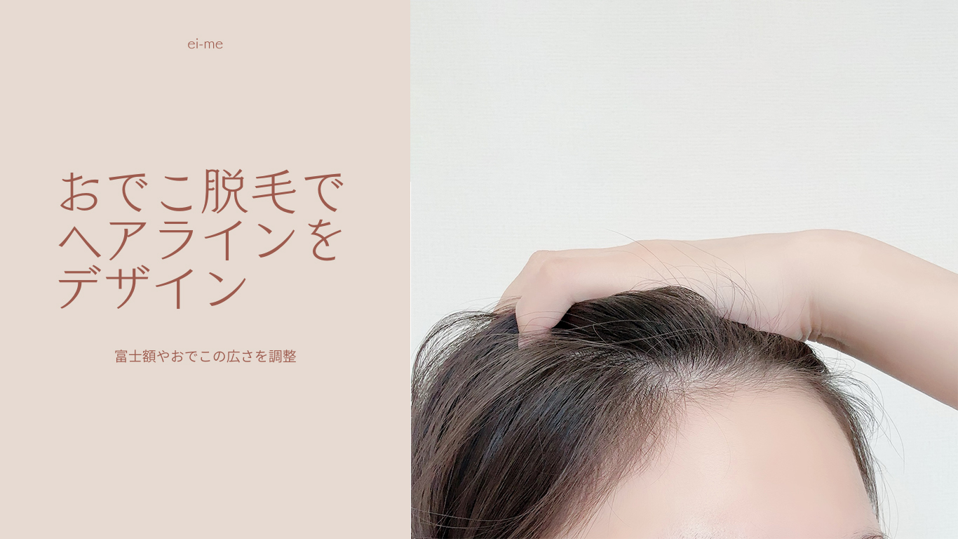 おでこ脱毛でヘアラインをデザイン