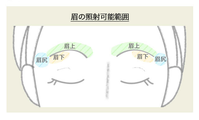 エイミーのお顔脱毛はキワギリギリ・眉周り（眉上・眉下・眉尻）にも対応